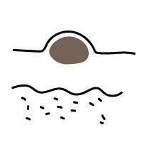 皮膚のできもの