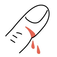 切り傷